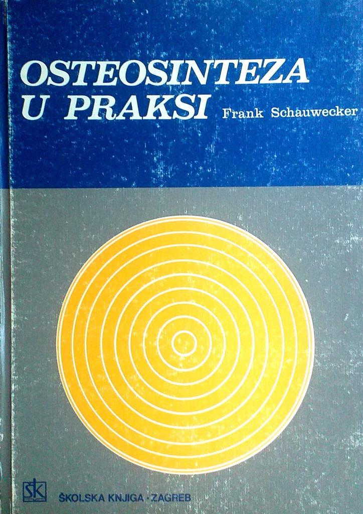 OSTEOSINTEZA U PRAKSI