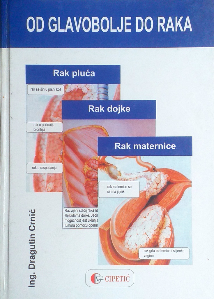 OD GLAVOBOLJE DO RAKA