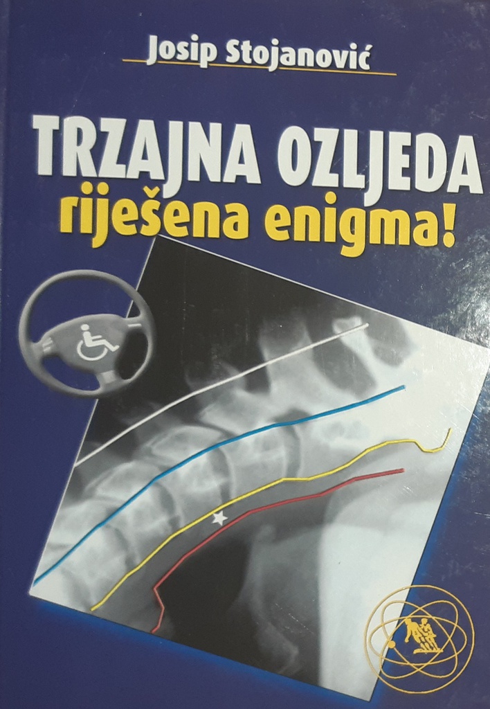 TRZAJNA OZLJEDA - RIJEŠENA ENIGMA!