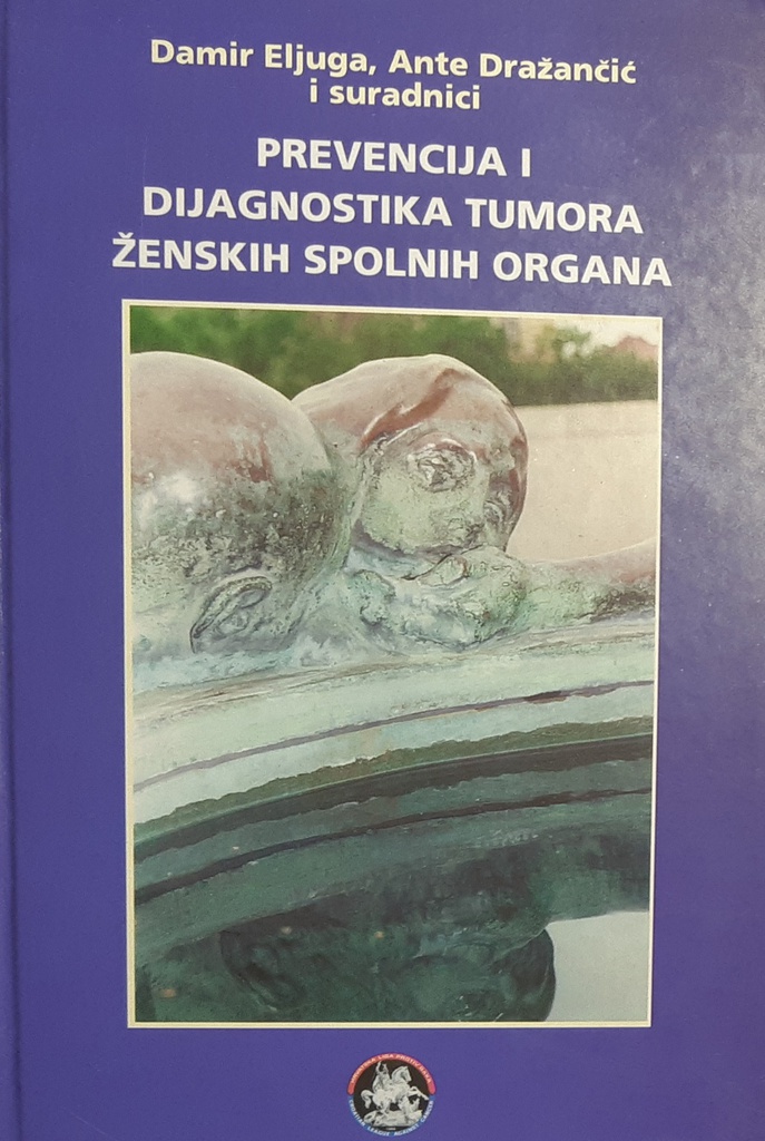 PREVENCIJA I DIJAGNOSTIKA TUMORA ŽENSKIH SPOLNIH ORGANA