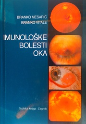 [C-11-5B] IMUNOLOŠKE BOLESTI OKA