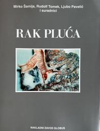 [E-02-1A] RAK PLUĆA